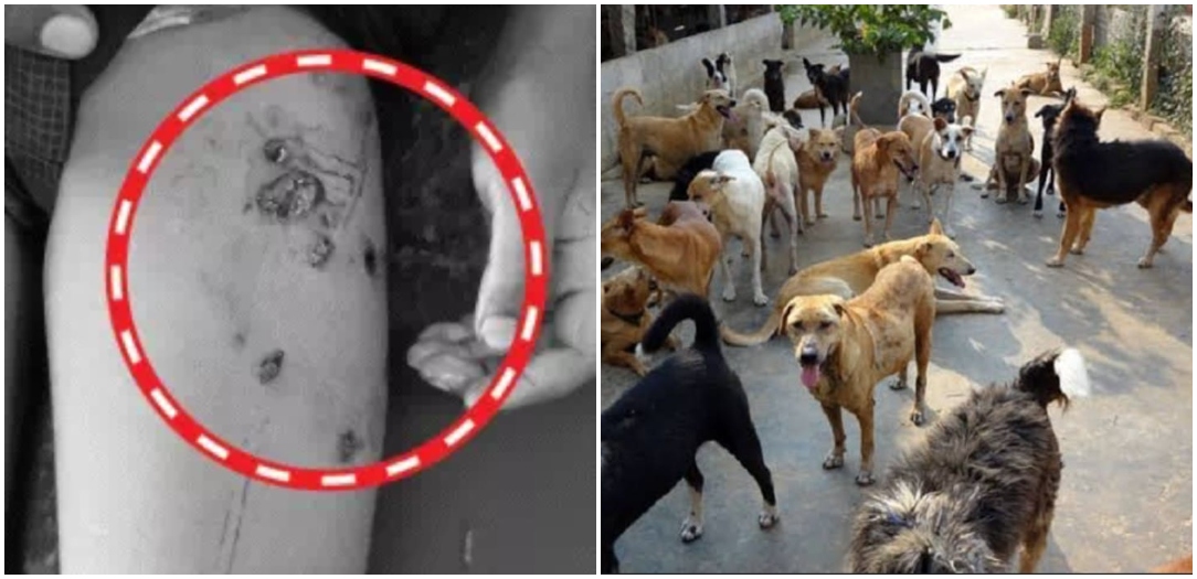One More Stray Dog Attack In Bihar Leaves One Child Dead, Another Critically Injured