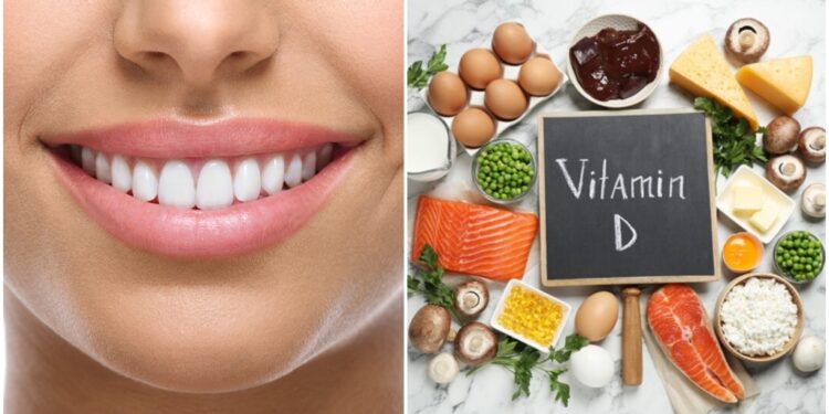 Yellow Teeth Could Mean a Lack of Vitamin D: Know How to Fix This Problem Naturally