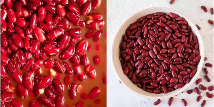 Eating Kidney Beans Could Boost Weight Loss: How Much to Include in Your Daily Diet