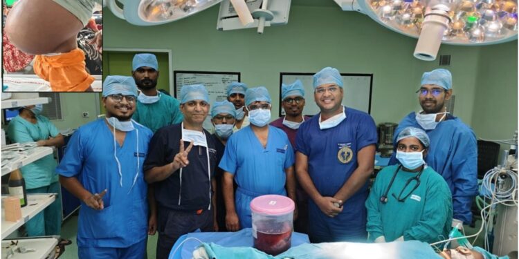 AIIMS Patna Doctors Remove 3.1 Kg Spleen From Six-Year-Old Boy in Rare Surgery