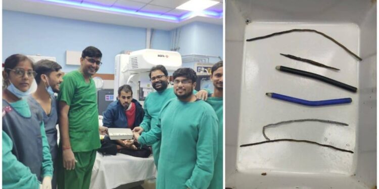 Life-Saving Procedure at IGIMS Patna: Sharp Wires and Pencil Removed from Inmate’s Stomach