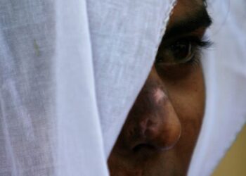 Woman Arrested for Plotting Acid Attack on Beautician Over Alleged Affair with Husband