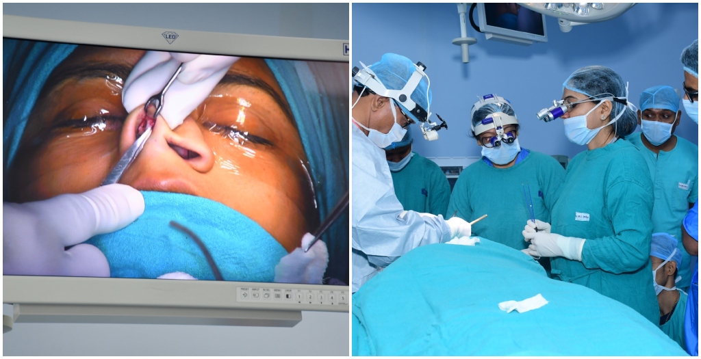 AIIMS Patna Hosts Two-Day Rhinoplasty Workshop for Surgeons