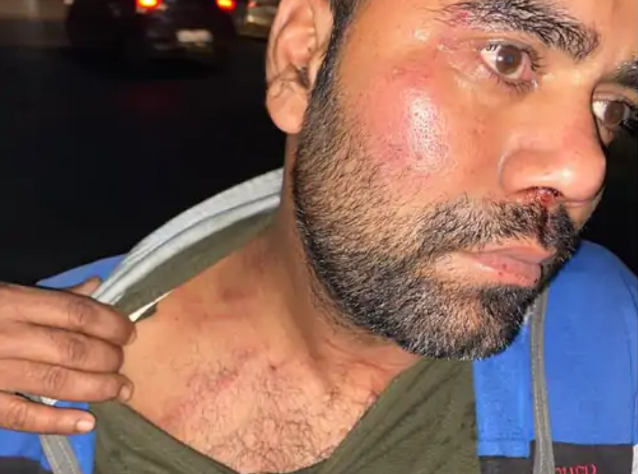 NMCH Doctor Dragged by Collar, Driver Beaten at Digha Checkpost; Complaint Filed Against SI and Five Other Officers