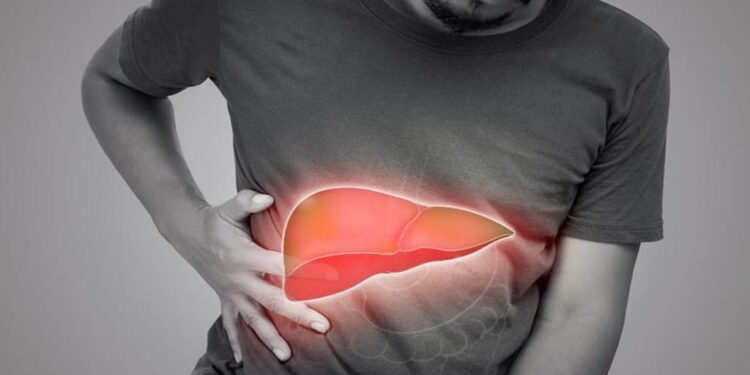 Is Your Liver Toxic? These 5 Ingredients Could Clean It Naturally — No Medicine Needed