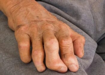 As Ageing Leprosy Drugs Falter, Bihar Dermatologists Turn to New Therapies and Awareness Drives Ahead of World Leprosy Day