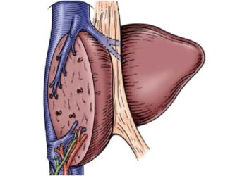 Three-Years-Old With Rare Liver Cancer Undergoes Complex Surgery in Patna