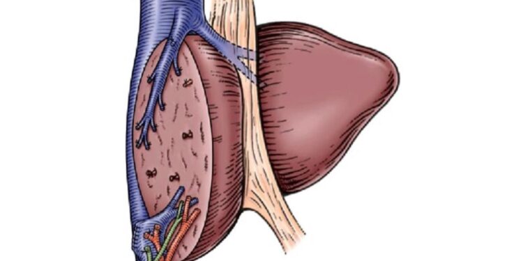Three-Years-Old With Rare Liver Cancer Undergoes Complex Surgery in Patna