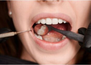 Neglecting Oral Hygiene and Tobacco Consumption Can Have Serious Consequences as Oral Cancer Risk Rises