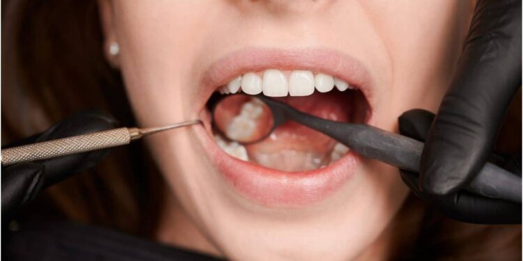 Neglecting Oral Hygiene and Tobacco Consumption Can Have Serious Consequences as Oral Cancer Risk Rises