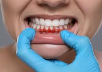 Patna Oral Health Crisis: 80% Youth Affected, Experts Warn Minor Symptoms Could Turn Deadly