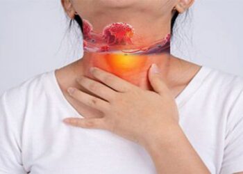 This Common Virus May Stay Silent for Years — Then Cause Throat Cancer