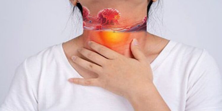This Common Virus May Stay Silent for Years — Then Cause Throat Cancer