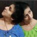 Who Are Saba and Farah, the Sisters Who Tied Rakhi to Salman Khan? Bihar's Expert Medical Team Will Now Visit Them Every Month