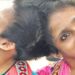Three Months Without Medicines: Why a Supreme Court Order Has Not Reached Patna’s Conjoined Sisters