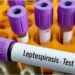 Second Leptospirosis Case Reported At NMCH In Five Days As Patna Sees Monsoon Risk Rise