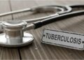Bihar Records Second-Highest Number Of New TB Cases, 1.14 Lakh Detected By June 2026
