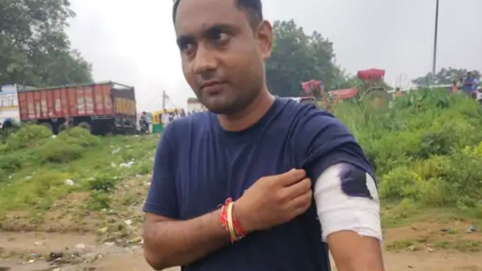 Patna Police-Criminals Encounter: 62 Rounds Fired, One Shot in Leg; SI Injured, SHO Suffers Head Injury